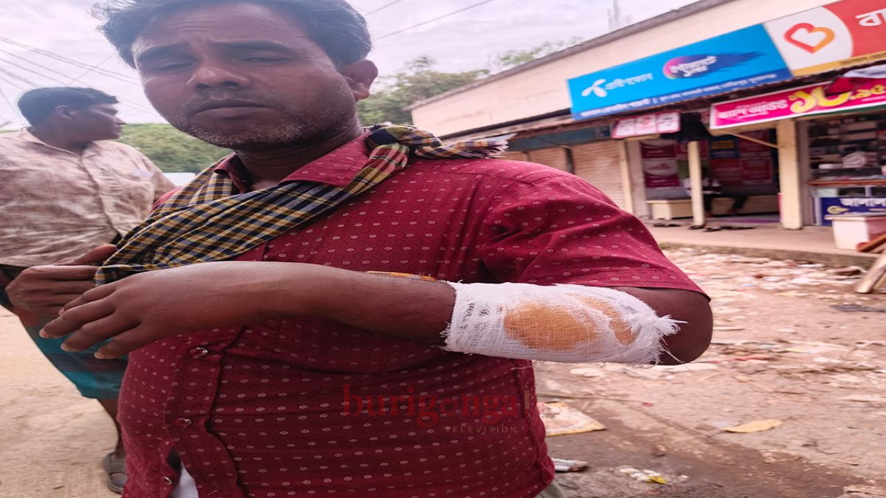 তাহিরপুরে জমি বিরোধে মামলা করায় নারীসহ ৬ জনকে কুপিয়ে জখম