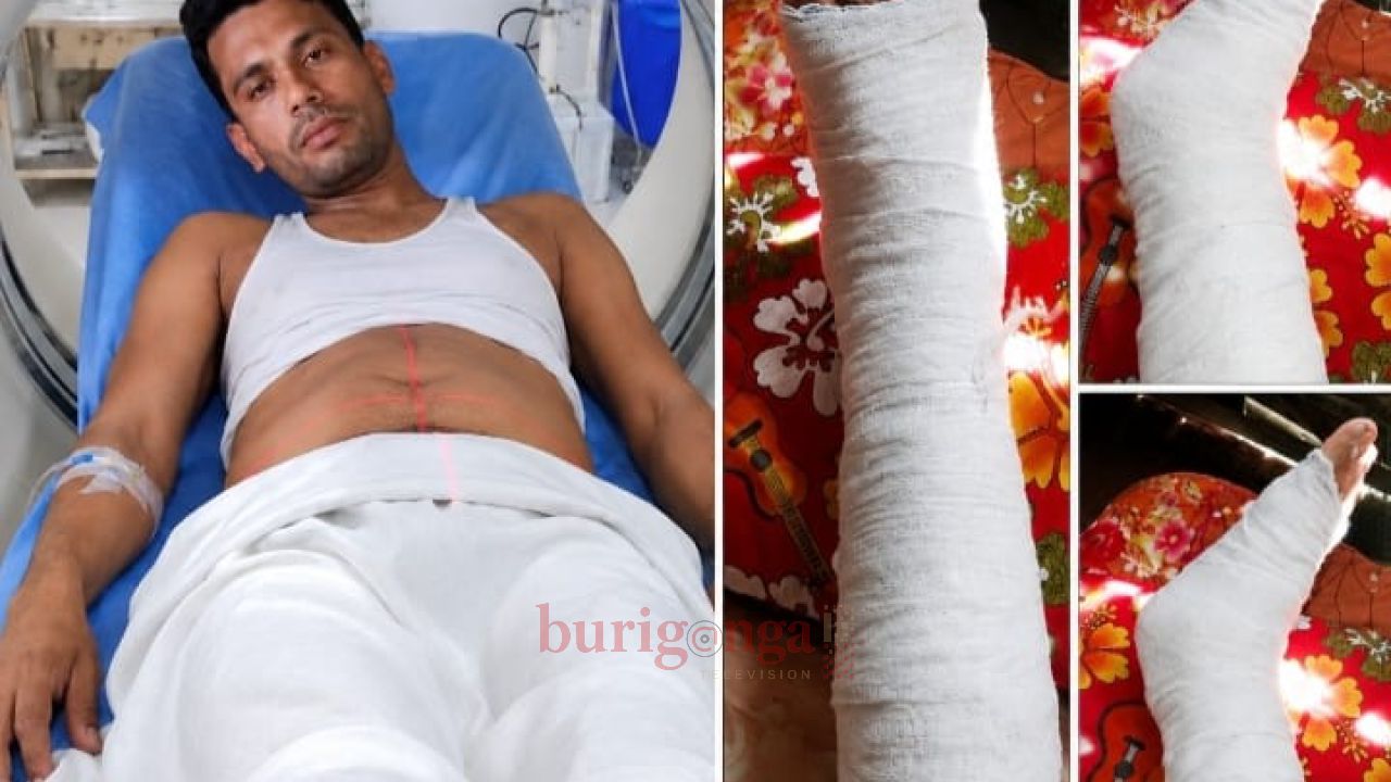 ওয়াইজ ধানমন্ডি বসিলা রাতের দুর্ঘটনা দোতলা থেকে পড়ে গুরুতর আহত সাংবাদিক শাফায়েত হোসেন